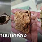 หวยกล่องคืออะไร